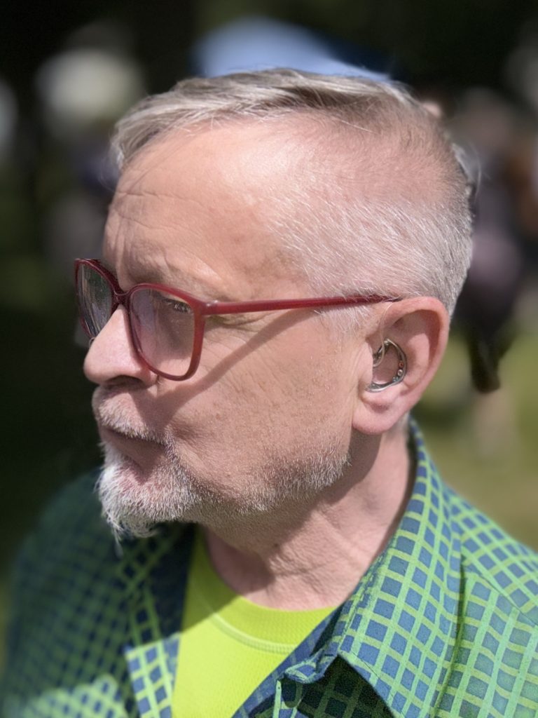Hans Piel aus Bonn ist rechts mit einem Cochlea-Implantat sowie links mit einem Hörsystem versorgt, das an sein CI gekoppelt ist. Besonderer Blickfang ist seine Titan-Schmuck-Otoplastik.